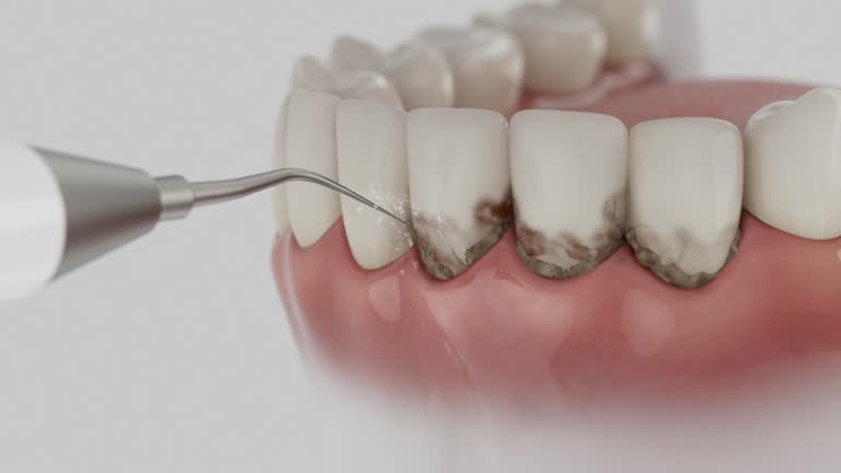 Reliable Dental contractor in Delaware, OH by Smile Center Dentistry